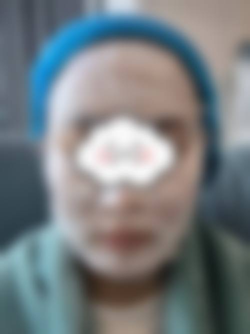 临沂欧美医疗整形美容诊所怎么预约？