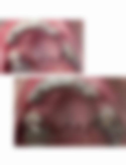 日常观察：关注牙齿和健康状况