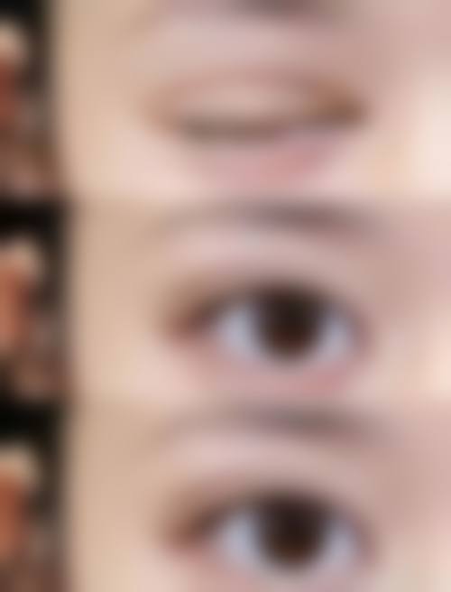 泰州拜欧医疗美容项目与价格介绍