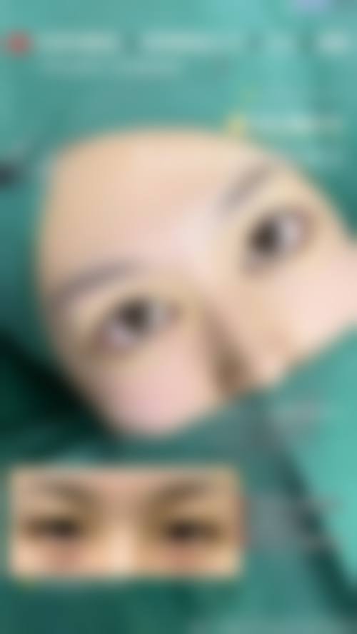 泰州拜欧医疗美容真实实例收集与优势提炼