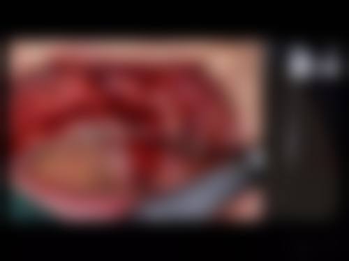 {永康浙爱口腔怎么样？正规资质可查，硕博医生领衔，种牙1880元起口碑佳