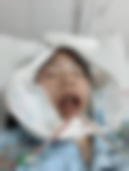 矫正牙齿前的准备：全方面检查，做好规划