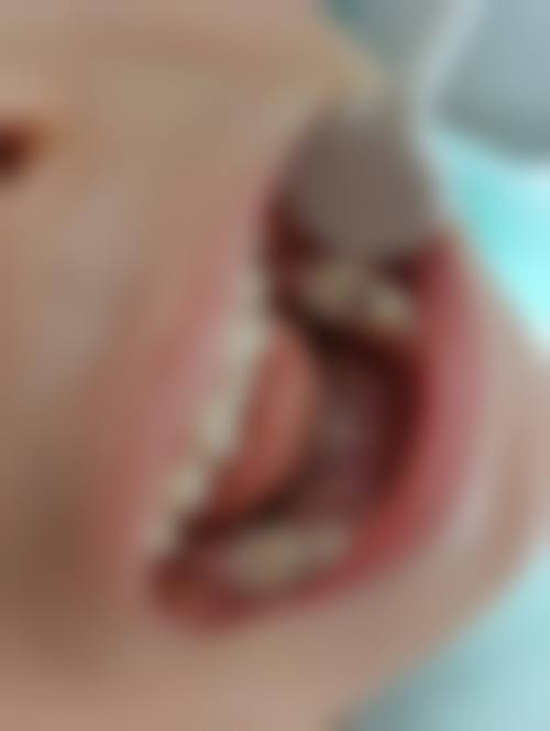 种植技术亮点多