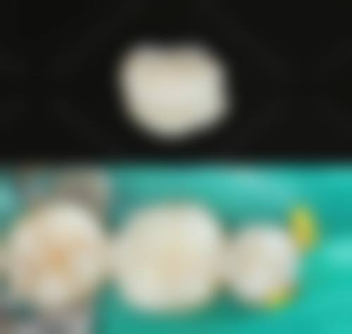 淮南杰美口腔镶牙特色