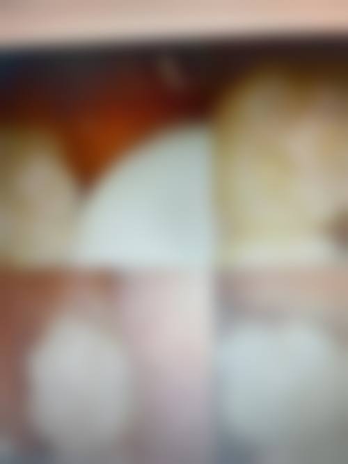 淮南益口口腔镶牙优势