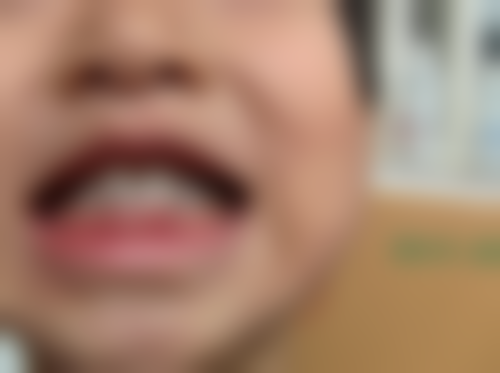 镶牙在线询问的重要性