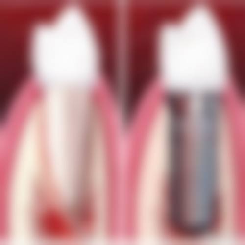 正常情况下的舒适体验