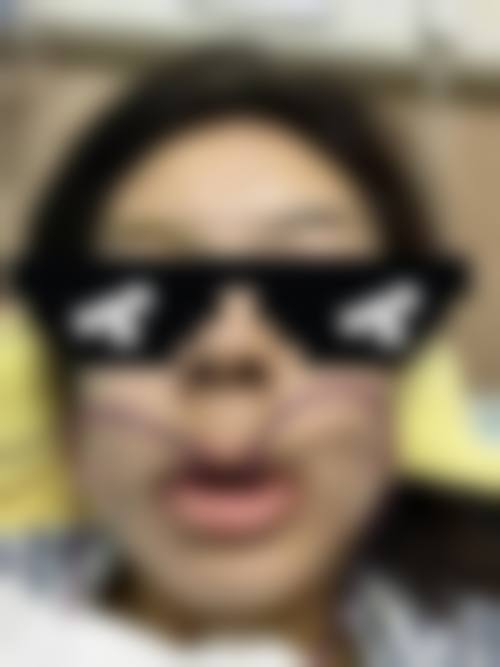 不同年龄段矫正牙齿的费用差异