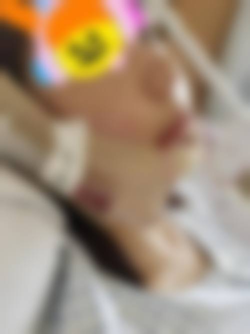 恒牙期：多种方法应对不同畸形