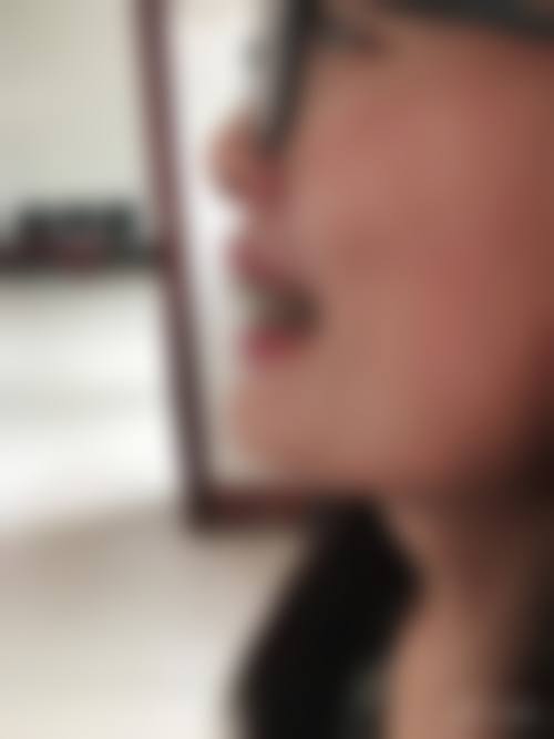 湛江致美口腔牙齿美白与其他项目价格