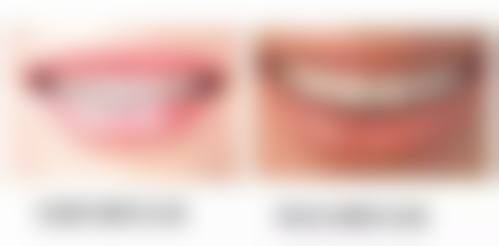 湛江致美口腔牙齿矫正价格与特色