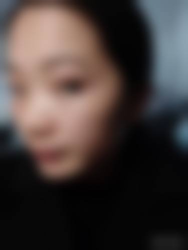 香格里拉悦她婕熹卡医疗美容诊所价格与联系方式