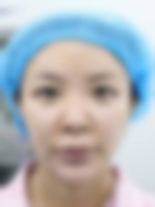 香格里拉悦她婕熹卡医疗美容诊所核心技术优势