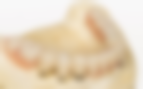 价格差异核心因素