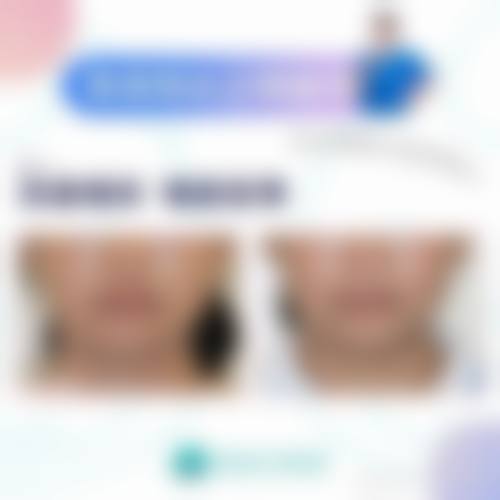 普洱（红十字）博爱医院整形美容科特色项目有哪些？