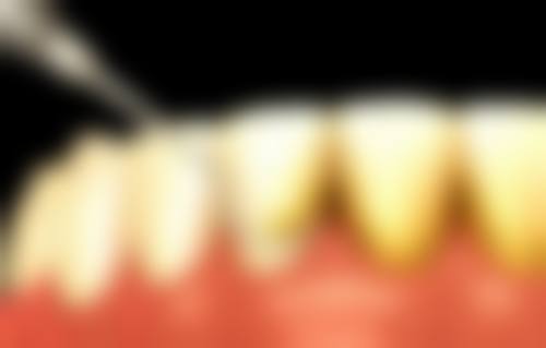 五、新华医院口腔科有啥亮点？