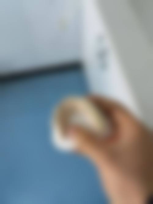 烤瓷冠1500元起收费详情