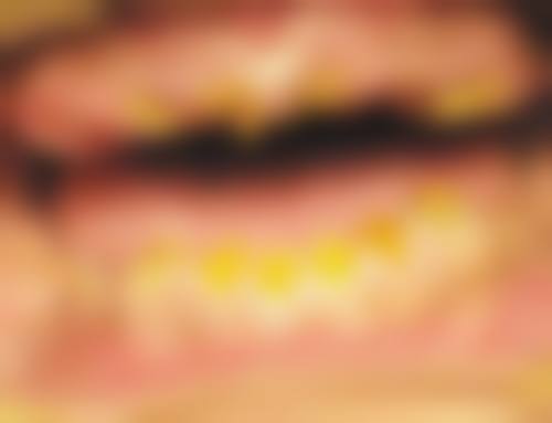 四、长海医院口腔科口碑如何？