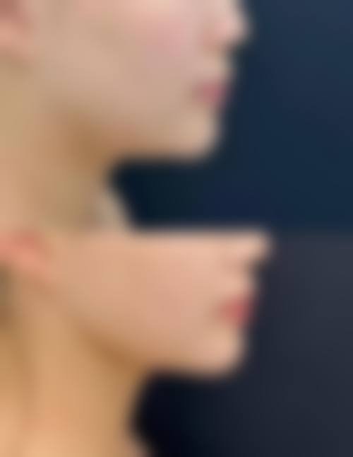 济宁柏年医疗美容医院用户反馈口碑（3条）