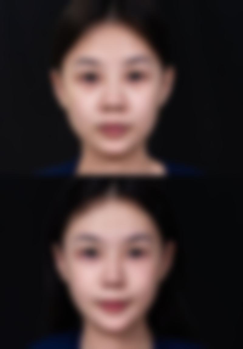 济宁柏年医疗美容医院开展项目范围