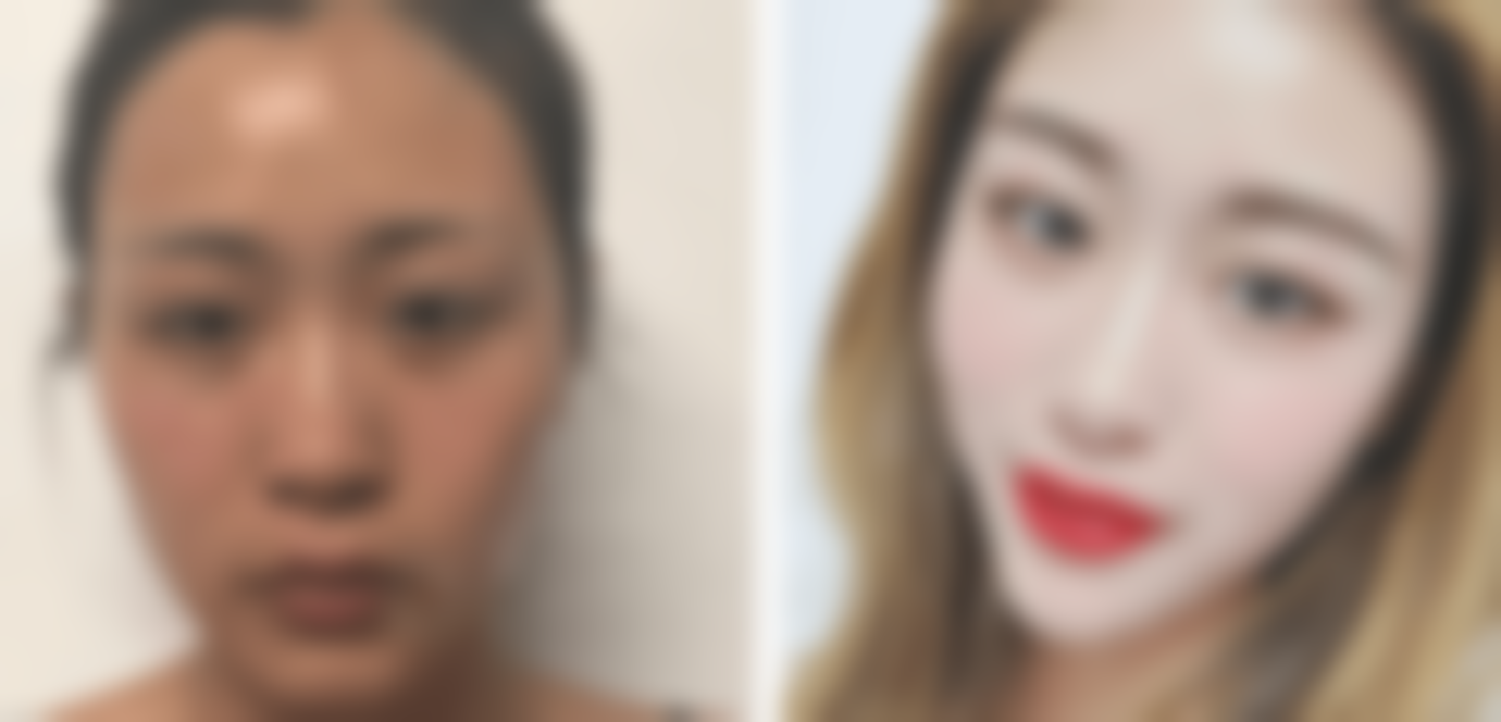 李寒松医生擅长项目