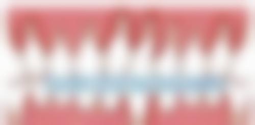 五、大庆儿童齿科医生在线询问24小时的实例分享