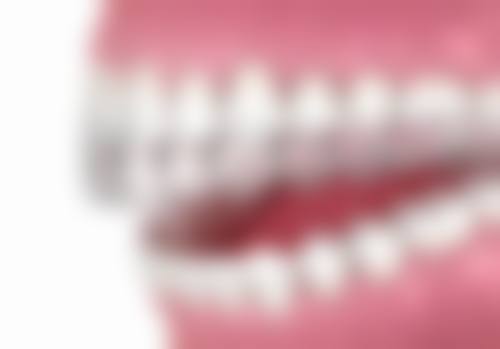 矫正牙齿拔牙的注意事项