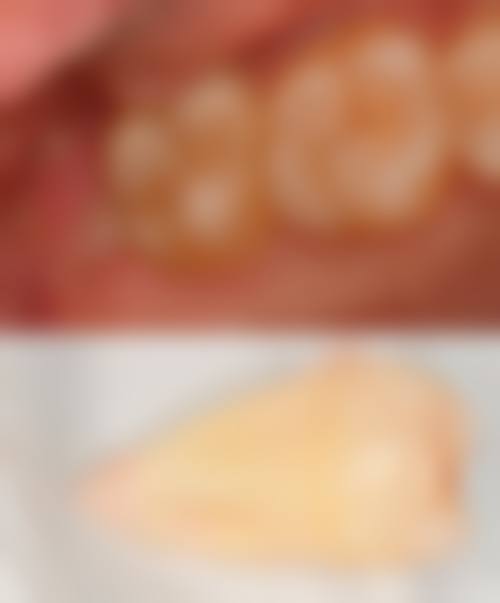 影响拔牙时间选择的因素