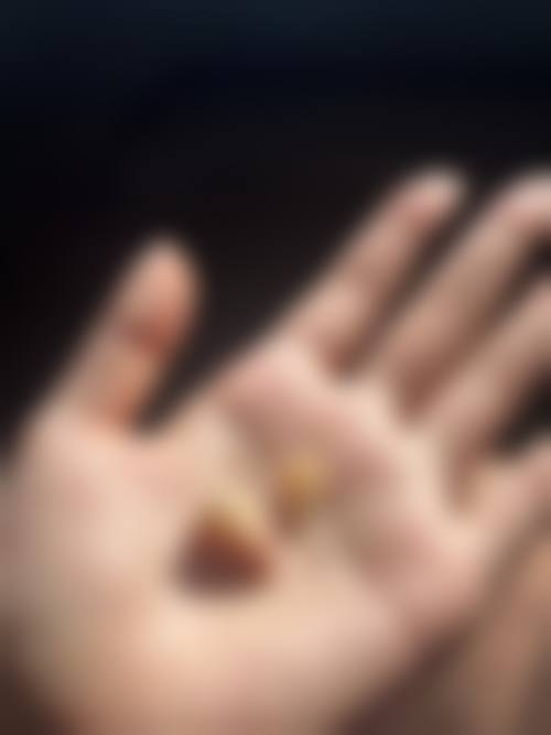 拔牙后的注意事项