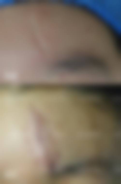 资阳艾唯斯医疗美容诊所详细的预约挂号方式及流程