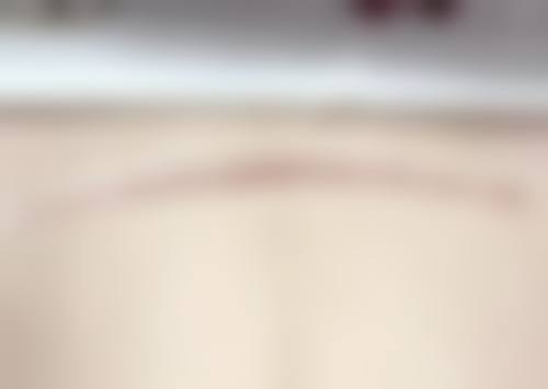 资阳艾唯斯医疗美容诊所真人口碑评价怎么样？