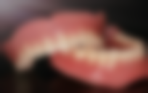 修复材料对华 西种牙价格的影响