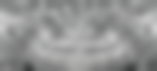 前牙根管治疗：低价高质守护美观笑容