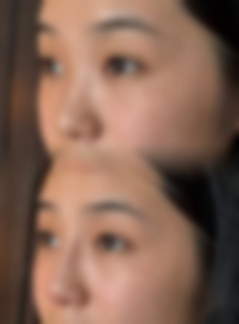 北京唐人汇美整形医疗美容门诊部重点项目解析