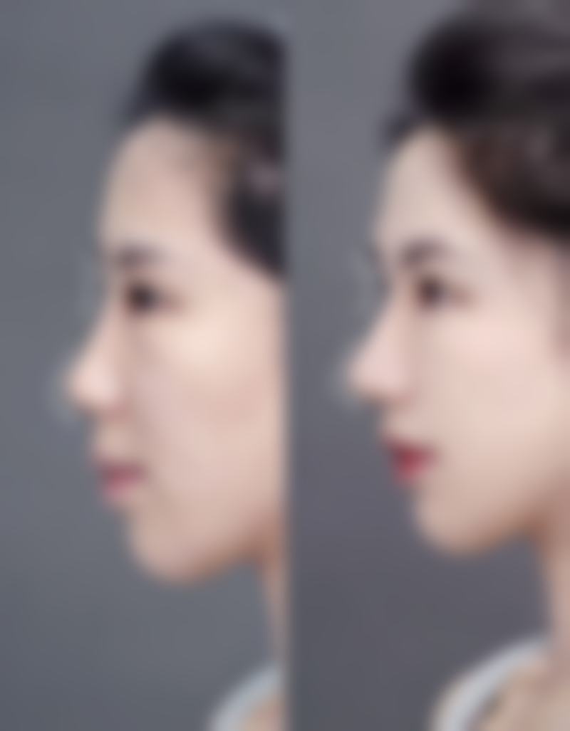 香港漾美整形医院特色项目及技术优势