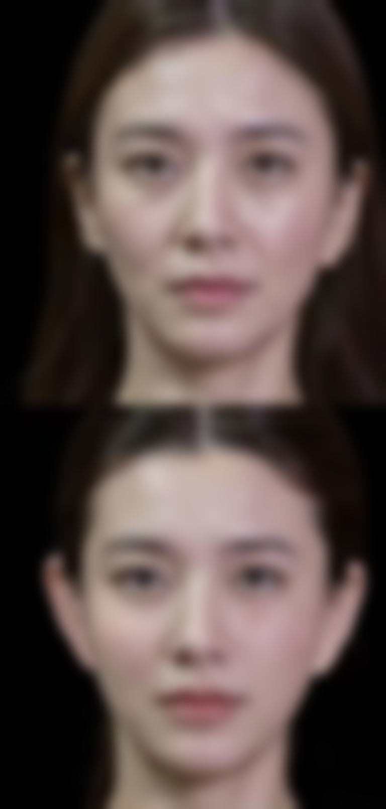 香港漾美整形医院口碑评价怎么样？