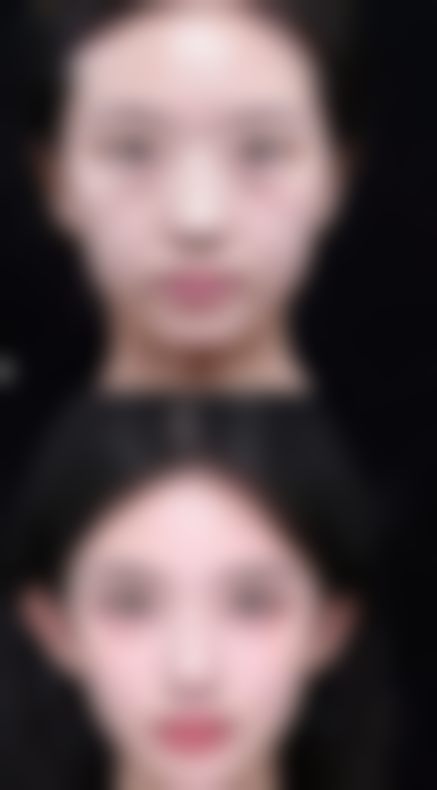 抚州美莱尔医疗美容门诊部用户反馈口碑（3条）