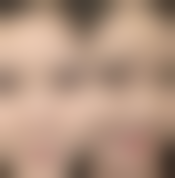 杭州芒塔玖运整形医院特色项目列表