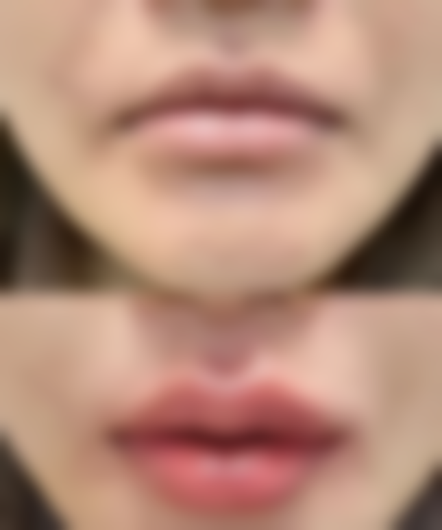 杭州芒塔玖运整形医院用户评价