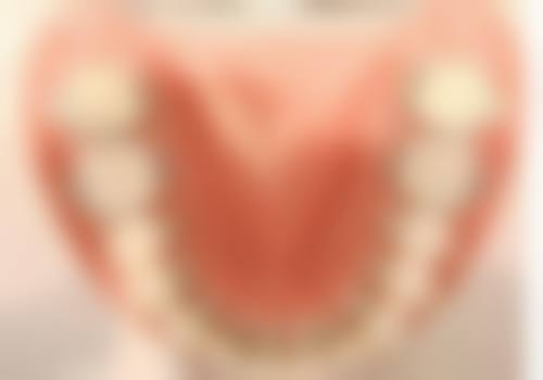 37岁矫正牙齿的实例分享