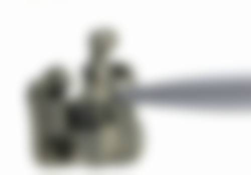 大同隐形矫正医生在线咨询24小时，大同易看牙门诊正畸专家为您解疑答惑！ 