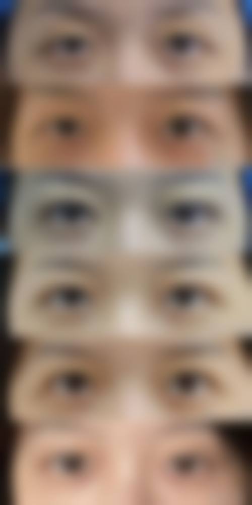 银川艾若（靓鑫）医疗美容诊所如何预约？