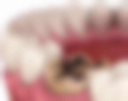 镶牙方式：多样选择满足不同需求