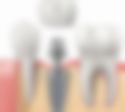 四、耐用性的对比分析