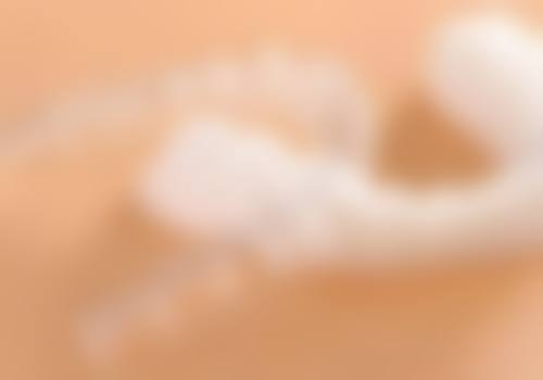 禾禾特色正畸技术