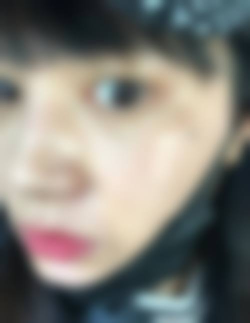 吴锐锋医生技术水平分析