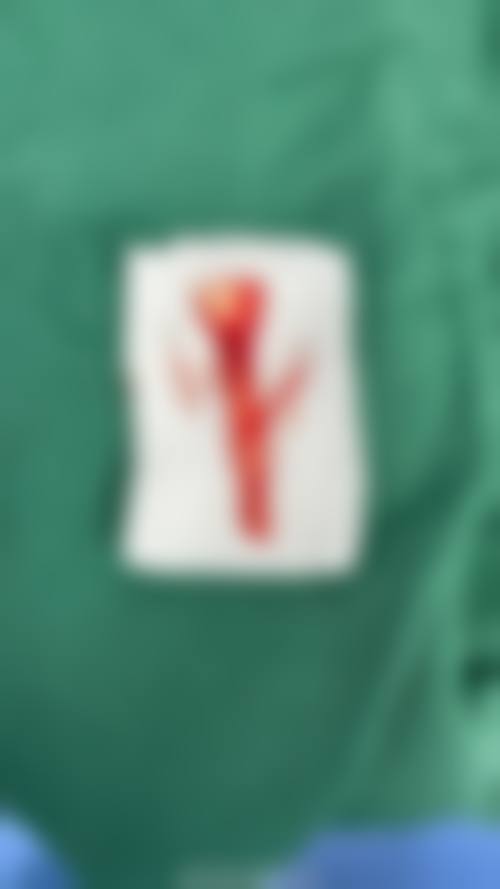 芮春昊医生擅长项目