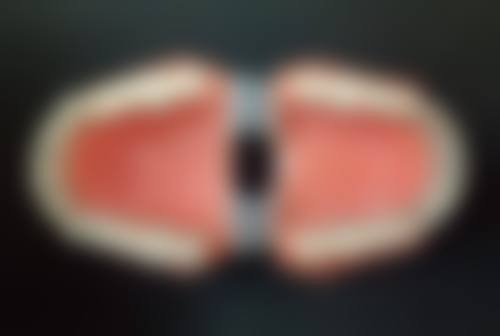 嘉兴海盐圣禾口腔镶牙靠谱的原因