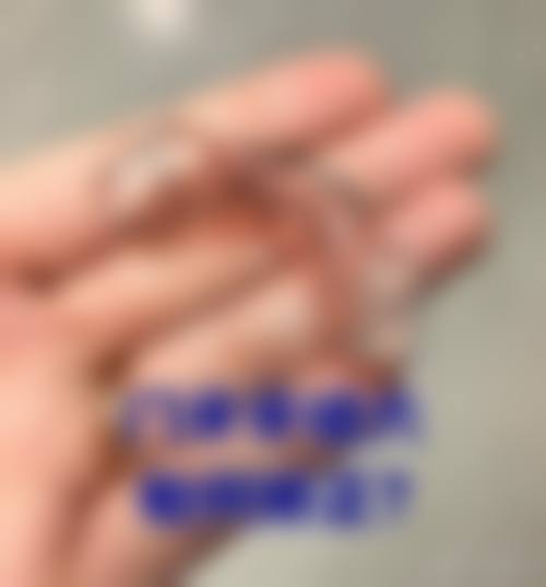 五、宁波千口百惠口腔门诊部的收费情况如何