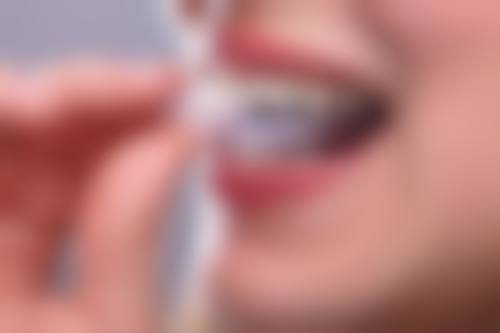 矫正牙的注意事项